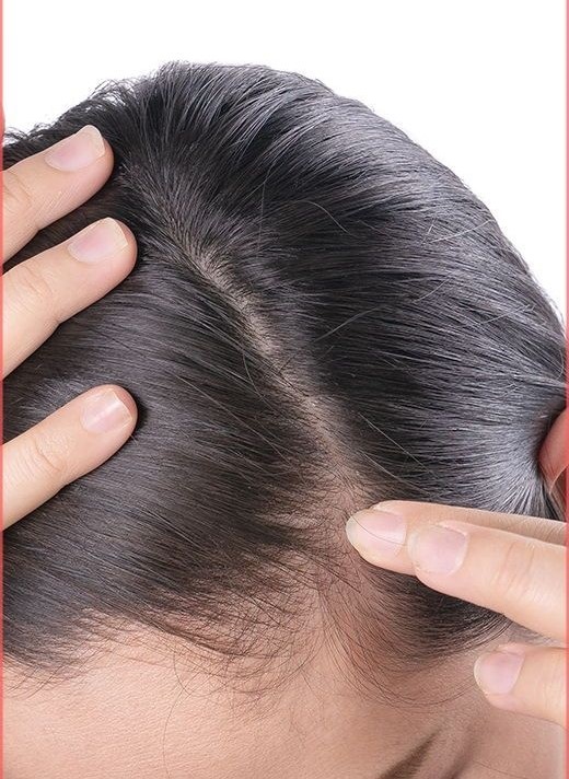 scalp care