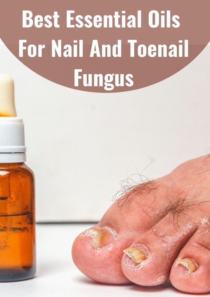 oil for toenail fungus