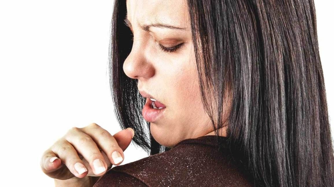 Dandruff causes and treatments