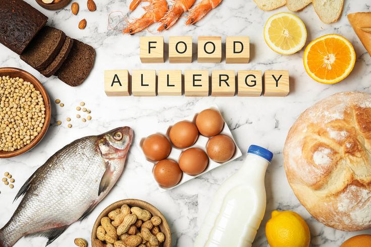 food allergy 